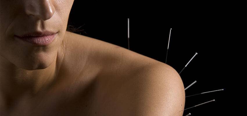 Acupuncture Shoulder Pain Treatment