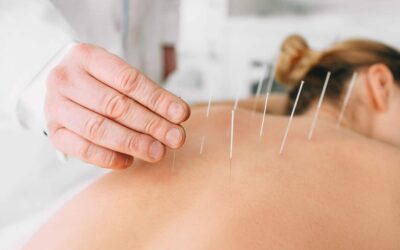 acupuncture in barrie