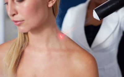cold laser therapy in barrie